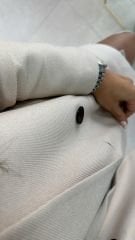 Foo Taş Blazer Ceket